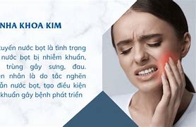 Tuyến Nước Bọt Mang Tai Nằm Ở Đâu